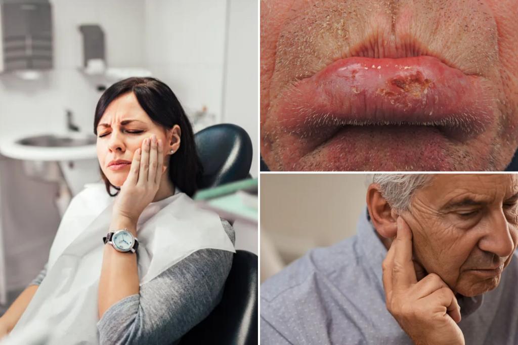 A loose tooth can be a sign of oral cancer - discovered 4 others